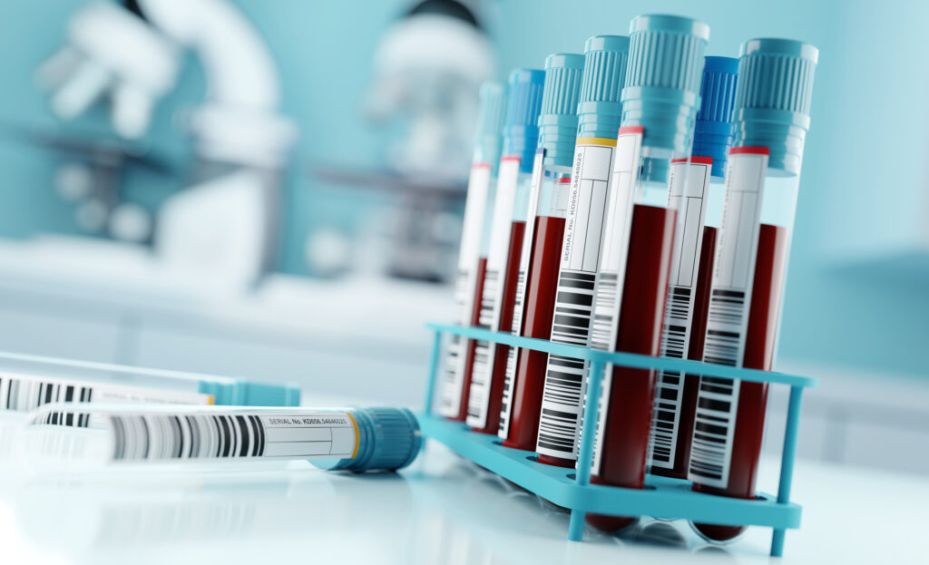 Photo of blood samples and test results in a clinical medical laboratory.