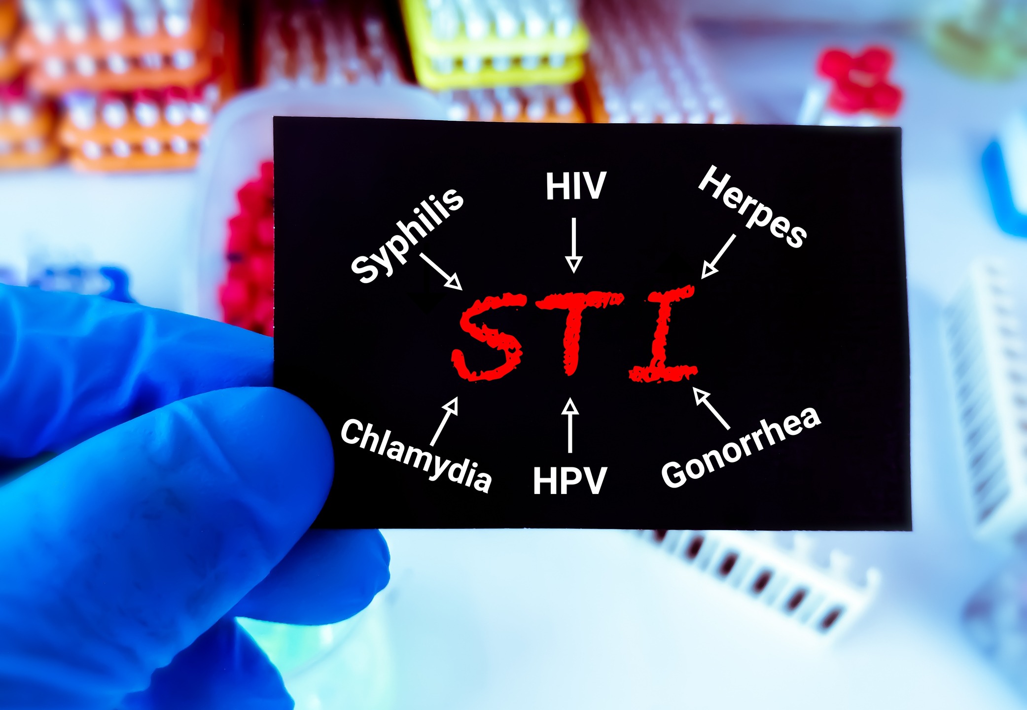 STI (Sexually Transmitted Infection) terms on a piece of paper held by a hand in a blue medical glove